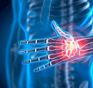 CRYOABLATION FOR BONE CANCER